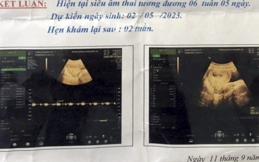 Bắt bảo vệ trường mầm non ở Nghệ An nghi xâm hại học sinh lớp 6 đến mang thai