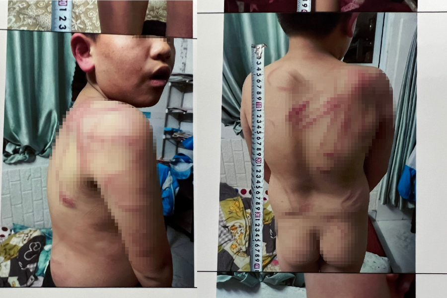 Lâm Đồng: Khởi tố người cha bạo hành con trai ruột như thời trung cổ