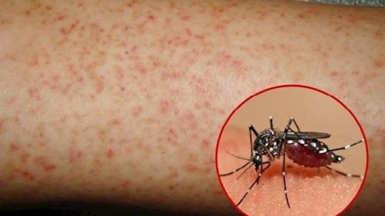 Quảng Nam ghi nhận hơn 11.800 ca sốt xuất huyết, đã có trường hợp tử vong