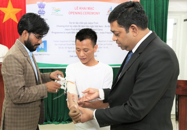 Ấn Độ viện trợ trại lắp chân tay giả Jaipur đầu tiên tại tỉnh Đắk Lắk