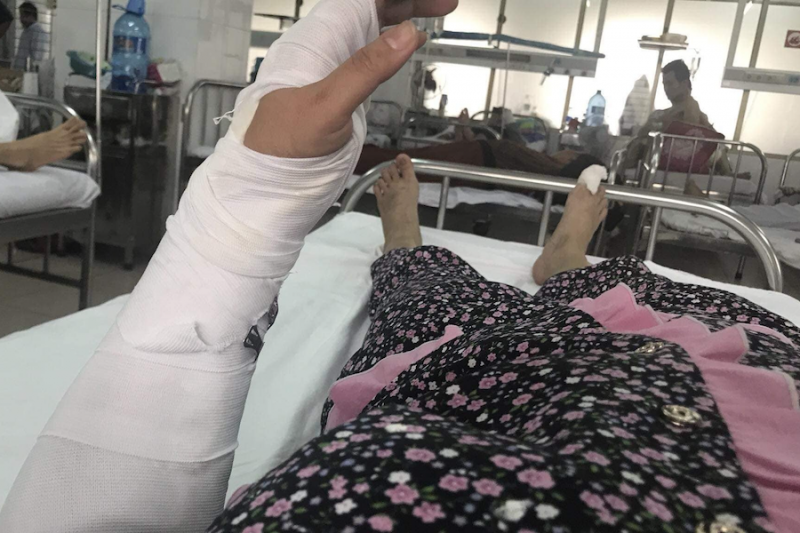 Đà Nẵng: Điều tra làm rõ vụ chồng đánh vợ dã man phải nhập viện cấp cứu