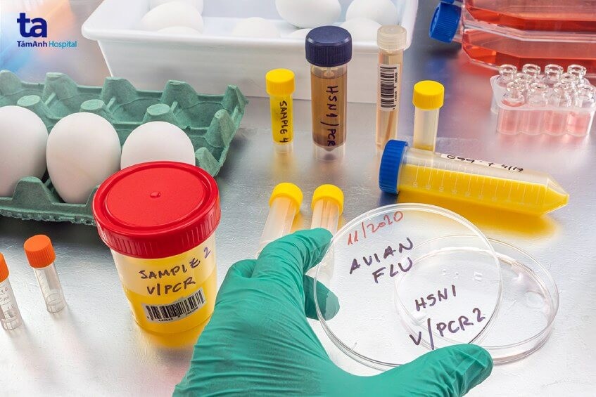 Cúm A H5N1: Triệu chứng, nguyên nhân và cách phòng ngừa
