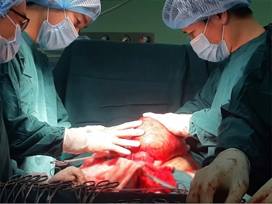 Bệnh viện Sản Nhi TWG Long An phẫu thuật thành công khối u xơ hơn 3kg