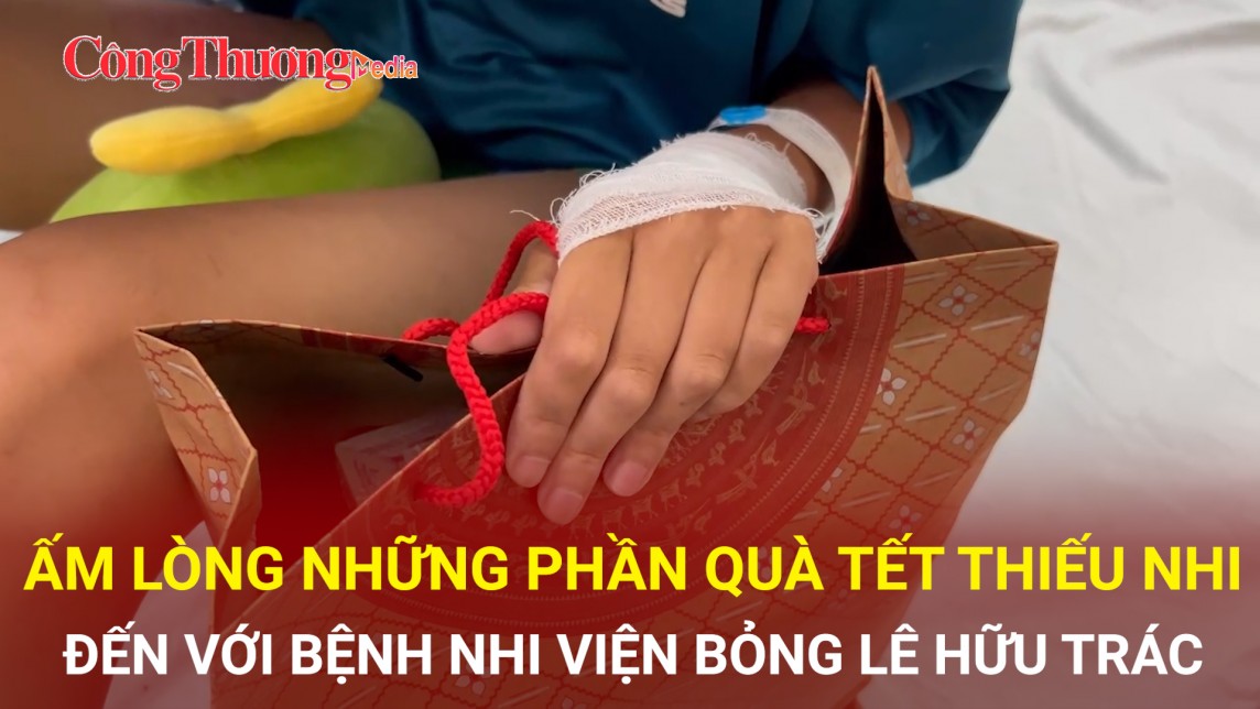 Ấm lòng những phần quà Tết thiếu nhi đến với bệnh nhi viện Bỏng Lê Hữu Trác